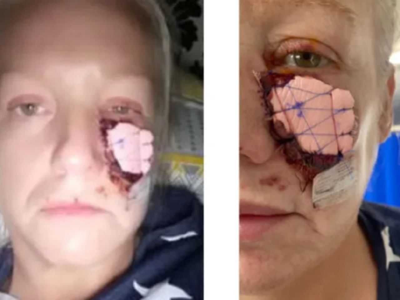 Cute dog bites woman's face and eats it: 'It ruined my life'