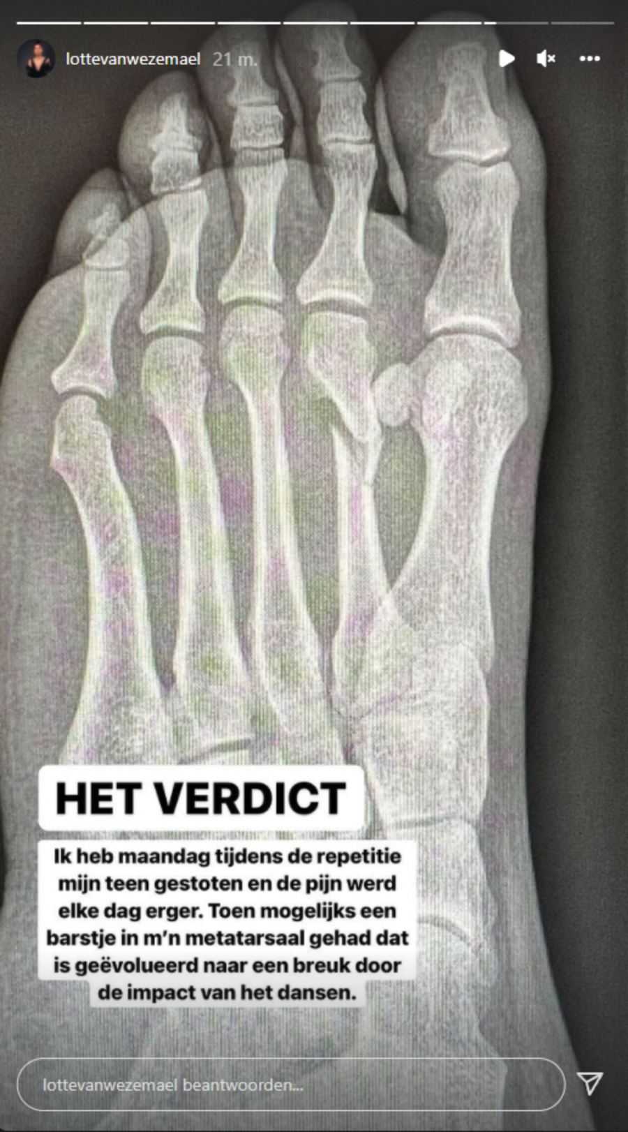 Lotte Vanwezemael, breuk