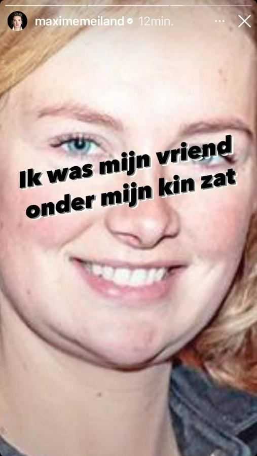 Maxime Meiland over plastische ingreep
