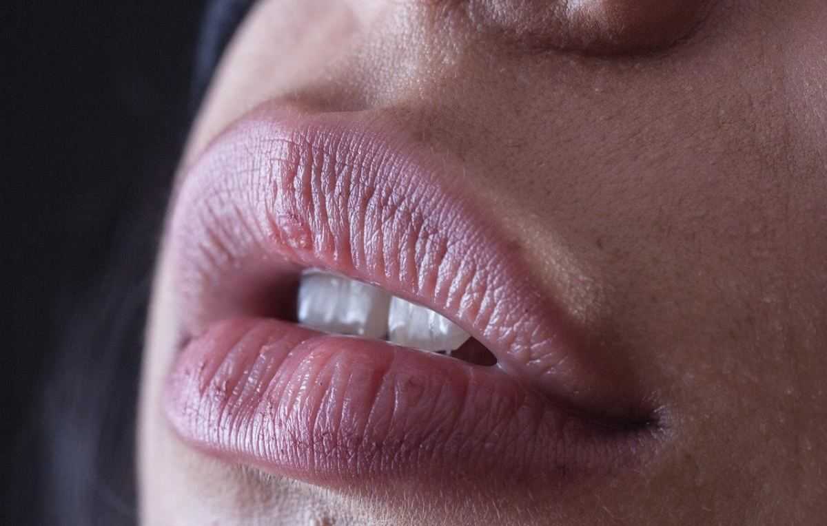 Lippen